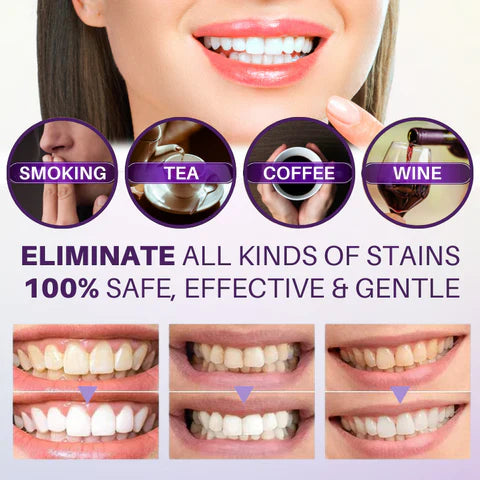 Teeth Brightening Colour Corrector Serum